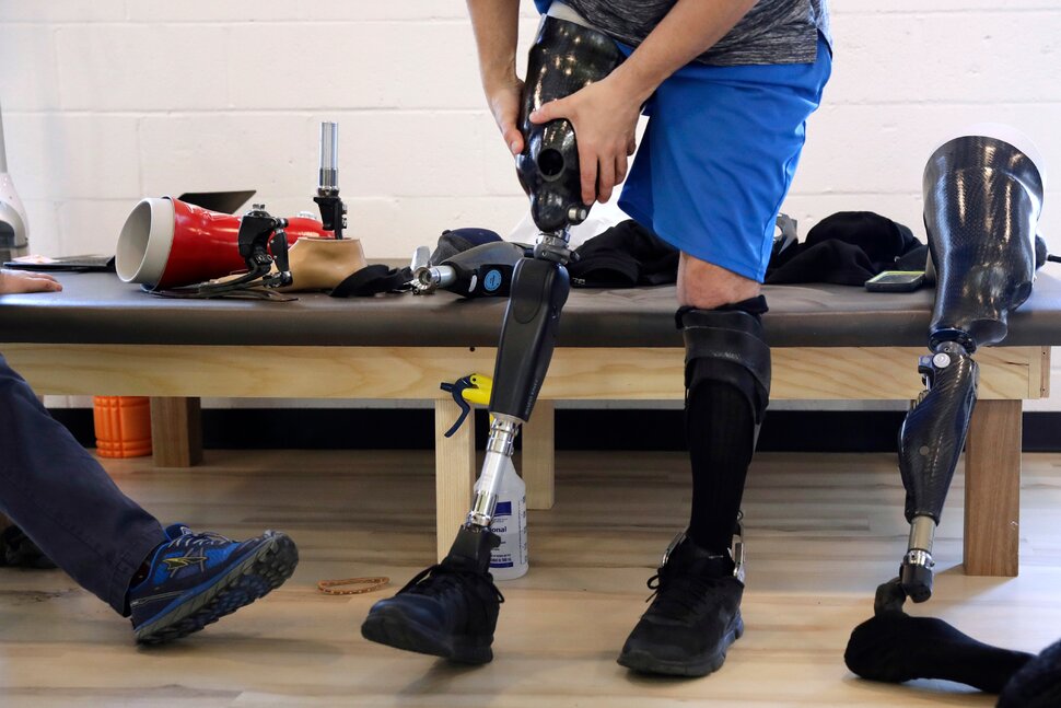 prosthetic leg fixing