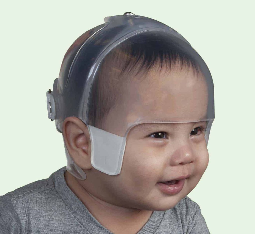 starlight bi valve infant head shaping helmet