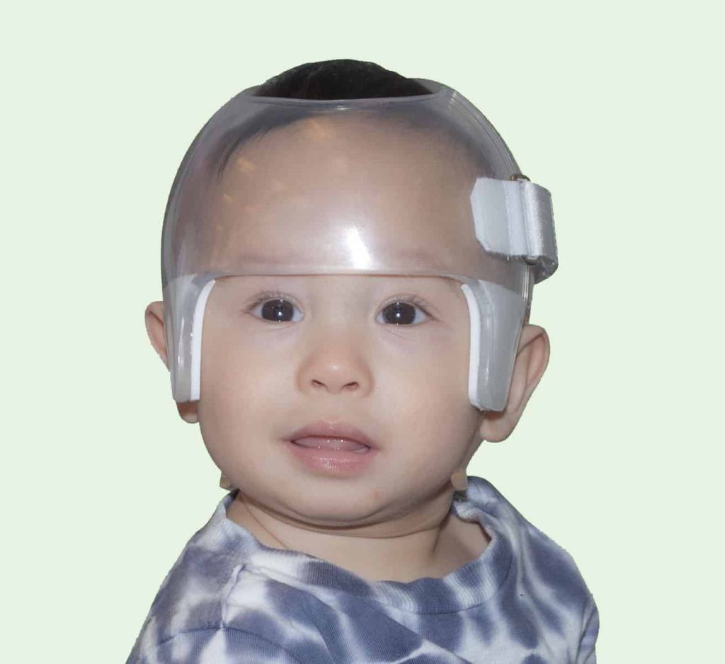 starlight side opening newborn head shaper