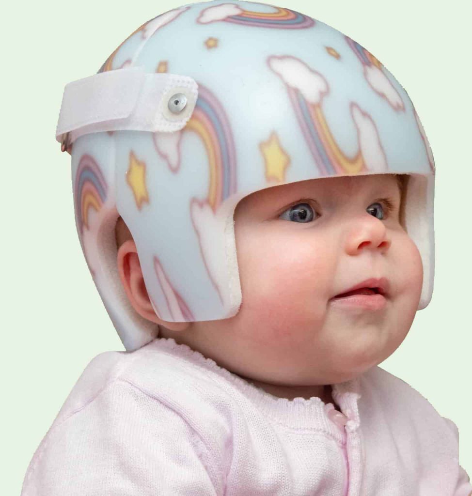 starband plus cranial remolding helmet