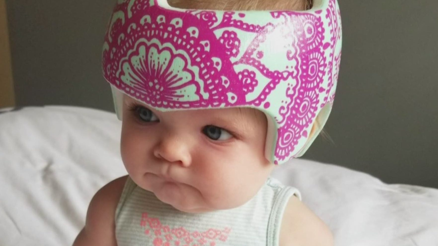 baby head shaping helmet designs