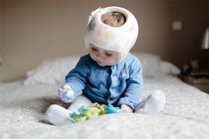 baby cranial helmet