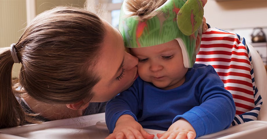 cranial helmet used by baby