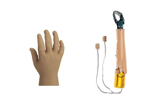 myoelectric paediatric prosthesis