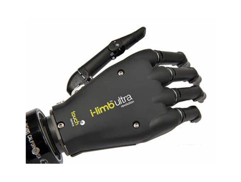 I-LIMB Ultra myo prosthetic hand