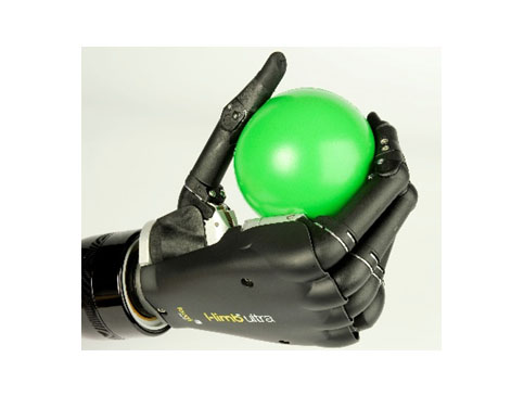 myo prosthetic hand